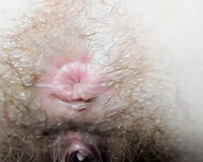 Extra cloused wink hairy asshole